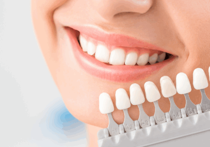 Brighten Your Smile: 7 Things To Know Before Your Teeth Whitening Treatment