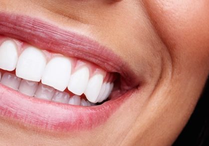 From Damage to a Beautiful Smile: A Real Patient’s Implant Journey at Seaham Smiles