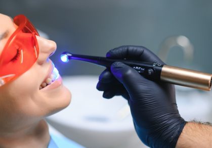 Strong, Natural, Virtually Invisible: Tooth-Coloured Fillings at Seaham Smiles