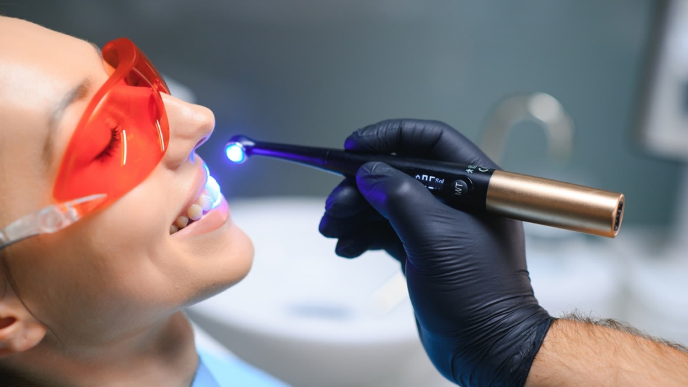 Tooth-Coloured Fillings